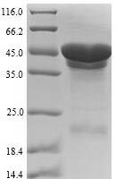 Escherichia coli Cytolethal distending toxin subunit B (cdtB) Recombinant Protein - BioCrest Sci