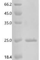 Human Protachykinin-1 (TAC1) Recombinant Protein, C-His - BioCrest Sci