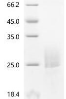 Corylus avellana Major pollen allergen Cor a 1 isoforms 5, 6, 11 and 16 Recombinant Protein, C-10His - BioCrest Sci