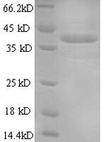 Mouse Annexin A1 (Anxa1) Recombinant Protein, N-His - BioCrest Sci