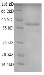 Mouse Annexin A1 (Anxa1) Recombinant Protein, N-His, Mus musculus (Mouse), E.coli, N-terminal 6xHis-tagged, 42.6 kDa, purity >≥ 90% as determined by SDS-PAGE.