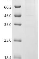 Mouse Integrin alpha-X (Itgax), partial Recombinant Protein, N-MBP/C-10His - BioCrest Sci