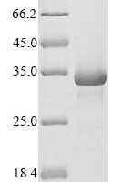 Mouse Complement C1q tumor necrosis factor-related protein 3 (C1qtnf3) Recombinant Protein - BioCrest Sci
