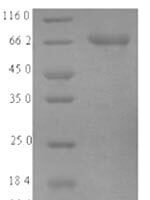 Human Acyl-CoA synthetase family member 2, mitochondrial (ACSF2) Recombinant Protein - BioCrest Sci