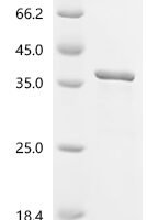 Human PX domain-containing protein 1 (PXDC1) Recombinant Protein - BioCrest Sci
