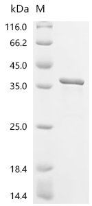 Human PX domain-containing protein 1 (PXDC1) Recombinant Protein, Homo sapiens (Human), E.coli, C-terminal 6xHis-tagged, 33.5 kDa, purity >≥ 85% as determined by SDS-PAGE.