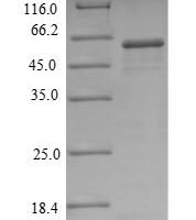 Human 5'-nucleotidase (NT5E), partial Recombinant Protein - BioCrest Sci