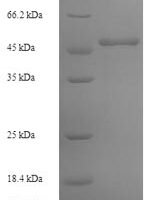 Arabidopsis thaliana Lycopene beta cyclase, chloroplastic (LCY1) Recombinant Protein, N-His - BioCrest Sci