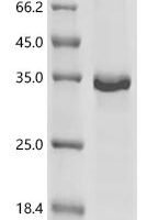Mouse Insulin-like growth factor-binding protein 6 (Igfbp6) Recombinant Protein - BioCrest Sci