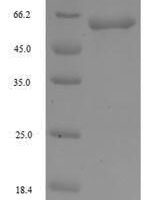 Human F-box/WD repeat-containing protein 4 (FBXW4) Recombinant Protein - BioCrest Sci