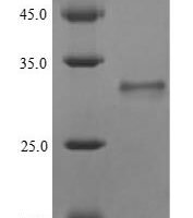 Human Unconventional myosin-VIIa (MYO7A), partial Recombinant Protein - BioCrest Sci