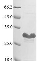 Escherichia coli O157:H7 Stringent starvation protein B (sspB) Recombinant Protein - BioCrest Sci