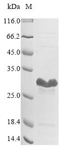 Escherichia coli O157:H7 Stringent starvation protein B (sspB) Recombinant Protein, Escherichia coli O157:H7, E.coli, N-terminal 6xHis-tagged, 22.3 kDa, purity >≥ 85% as determined by SDS-PAGE.