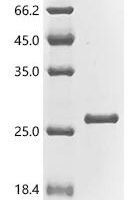Streptococcus pyogenes serotype M3 Arginine repressor (argR2) Recombinant Protein - BioCrest Sci