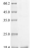 Human DNA-directed RNA polymerase III subunit RPC10 (POLR3K) Recombinant Protein, C-His - BioCrest Sci