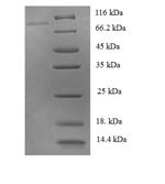 Human Tyrosine-protein phosphatase non-receptor type 6 (PTPN6) Recombinant Protein - BioCrest Sci