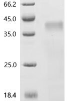 Mouse Bridging integrator 1 (Bin1), partial Recombinant Protein, N-His-SUMOstar - BioCrest Sci