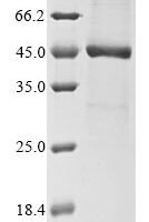 Human herpesvirus 7 Probable ganciclovir kinase (U69), partial Recombinant Protein - BioCrest Sci