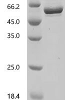Human Mitogen-activated protein kinase 8 (MAPK8) Recombinant Protein - BioCrest Sci