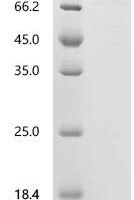 Mouse Protein Wnt-4 (Wnt4) Recombinant Protein, C-10His-HSA - BioCrest Sci