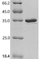 Rat Insulin receptor substrate 1 (Irs1), partial Recombinant Protein - BioCrest Sci
