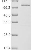 Human Dystroglycan (DAG1), partial Recombinant Protein, N-10His/C-Myc, aa 30–653, Baculovirus - BioCrest Sci