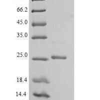 Mouse Ephrin-B3 (Efnb3), partial Recombinant Protein, N-His, aa 28–227, E.coli - BioCrest Sci
