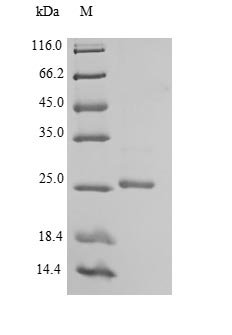 Mouse Ephrin-B3 (Efnb3), partial Recombinant Protein, N-His, aa 28–227, E.coli, Mus musculus (Mouse), E.coli, N-terminal 6xHis-tagged, 26.0 kDa, purity >≥ 90% as determined by SDS-PAGE.
