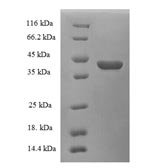 Human Cellular retinoic acid-binding protein 1 (CRABP1) Recombinant Protein - BioCrest Sci