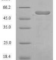 Human Angiotensinogen (AGT), partial Recombinant Protein - BioCrest Sci