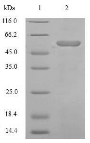 Human Angiotensinogen (AGT), partial Recombinant Protein, Homo sapiens (Human), E.coli, N-terminal 6xHis-SUMO-tagged, 57.9 kDa, purity >≥ 90% as determined by SDS-PAGE.