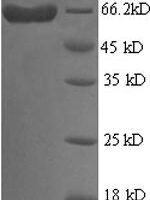 Human Galectin-9 (LGALS9) Recombinant Protein, N-His-GST - BioCrest Sci