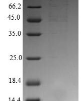 Human Orexin/Hypocretin receptor type 1 (HCRTR1), partial Recombinant Protein, N-10His/C-Myc - BioCrest Sci