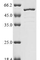Rat Troponin T, cardiac muscle (Tnnt2) Recombinant Protein, N-10His - BioCrest Sci