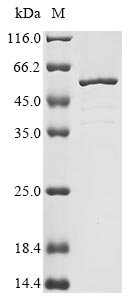 Rat Troponin T, cardiac muscle (Tnnt2) Recombinant Protein, N-10His, Rattus norvegicus (Rat), E.coli, N-terminal 10xHis-tagged, 41.6 kDa, purity >≥ 85% as determined by SDS-PAGE.
