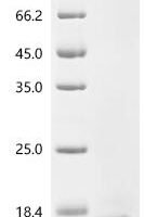 Dog Copper transport protein ATOX1 (ATOX1) Recombinant Protein - BioCrest Sci