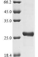 Human Eukaryotic translation initiation factor 4E (EIF4E) (S209D,W73A) Recombinant Protein - BioCrest Sci