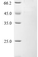 Adeno-associated virus 2 Protein Rep78 (Rep78) Recombinant Protein, N-10His-MBP - BioCrest Sci