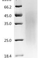 Mouse Iroquois-class homeodomain protein IRX-2 (Irx2) Recombinant Protein - BioCrest Sci