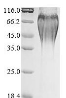 Mesocricetus auratus Placenta-expressed transcript 1 protein (PLET1) Recombinant Protein - BioCrest Sci