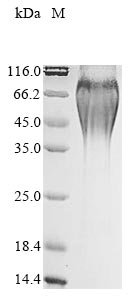Mesocricetus auratus Placenta-expressed transcript 1 protein (PLET1) Recombinant Protein, Mesocricetus auratus (Golden hamster), Mammalian cell, N-terminal 10xHis-tagged and C-terminal Myc-tagged, 25.8 kDa, purity >≥ 90% as determined by SDS-PAGE.