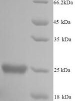 Mouse Glutathione S-transferase P 1 (Gstp1) Recombinant Protein - BioCrest Sci