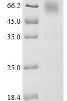 Human Adhesion G protein-coupled receptor L3 (ADGRL3), partial Recombinant Protein, N-10His/C-Myc - BioCrest Sci