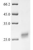 Human Protein RRP5 homolog (PDCD11), partial Recombinant Protein - BioCrest Sci