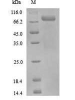 Human Protein-arginine deiminase type-3 (PADI3) Recombinant Protein - BioCrest Sci