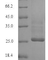 Human Potassium voltage-gated channel subfamily D member 1 (KCND1), partial Recombinant Protein - BioCrest Sci