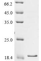 Rat Brevican core protein (Bcan), partial Recombinant Protein, N-10His/C-Myc - BioCrest Sci