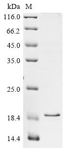 Rat Brevican core protein (Bcan), partial Recombinant Protein, N-10His/C-Myc, Rattus norvegicus (Rat), Baculovirus, N-terminal 10xHis-tagged and C-terminal Myc-tagged, 19 kDa, purity >≥ 90% as determined by SDS-PAGE.