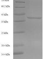 Bryonia dioica Ribosome-inactivating protein bryodin I, partial Recombinant Protein, N-His-SUMO - BioCrest Sci