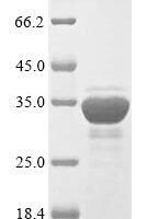 Saccharomyces cerevisiae Heat shock protein SSA1 (SSA1), partial Recombinant Protein - BioCrest Sci